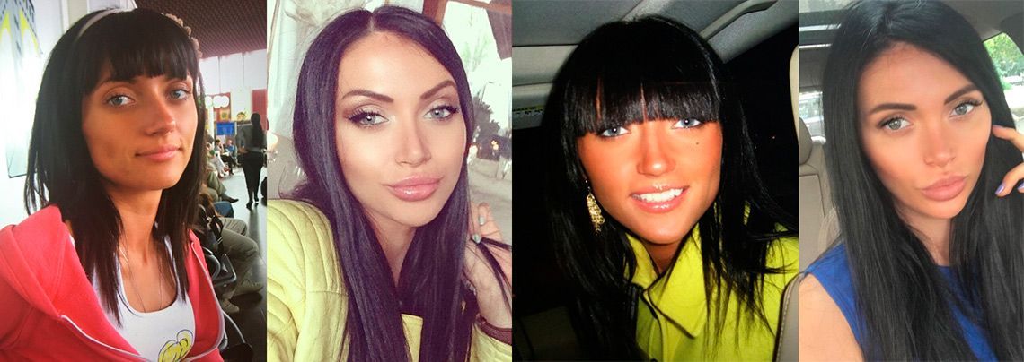 Марина Майер до и после пластики