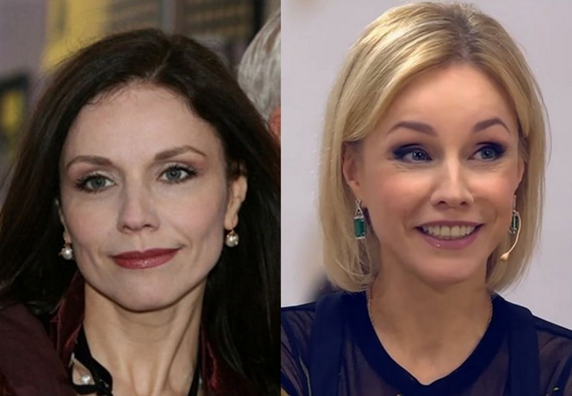 Марина Зудина до и после пластики