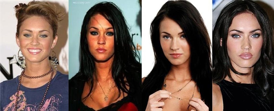 Меган Фокс до&nbsp;и&nbsp;после пластики