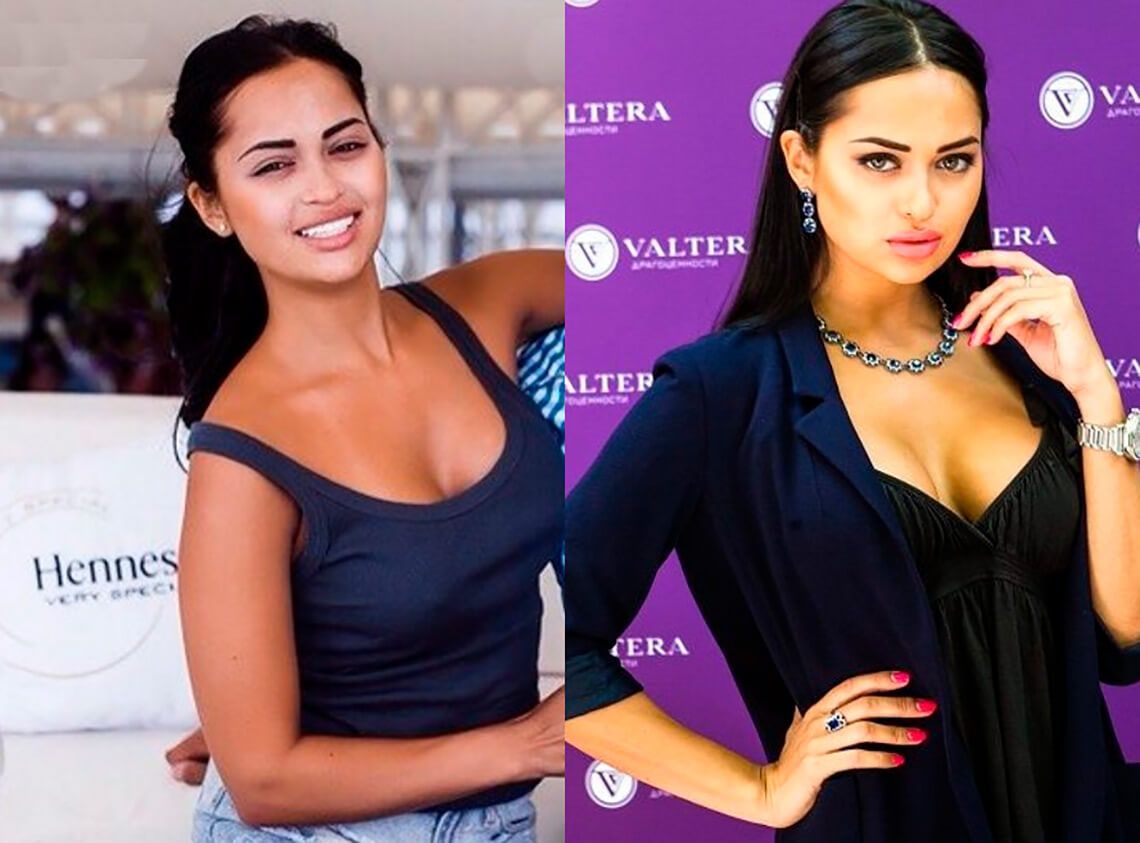 Нита Кузьмина до&nbsp;и&nbsp;после