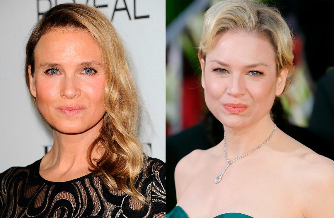 Рене Зеллвегер до&nbsp;и&nbsp;после