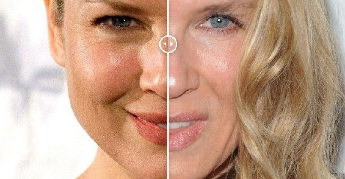 ене Зеллвегер до&nbsp;и&nbsp;после пластики. Сравнение