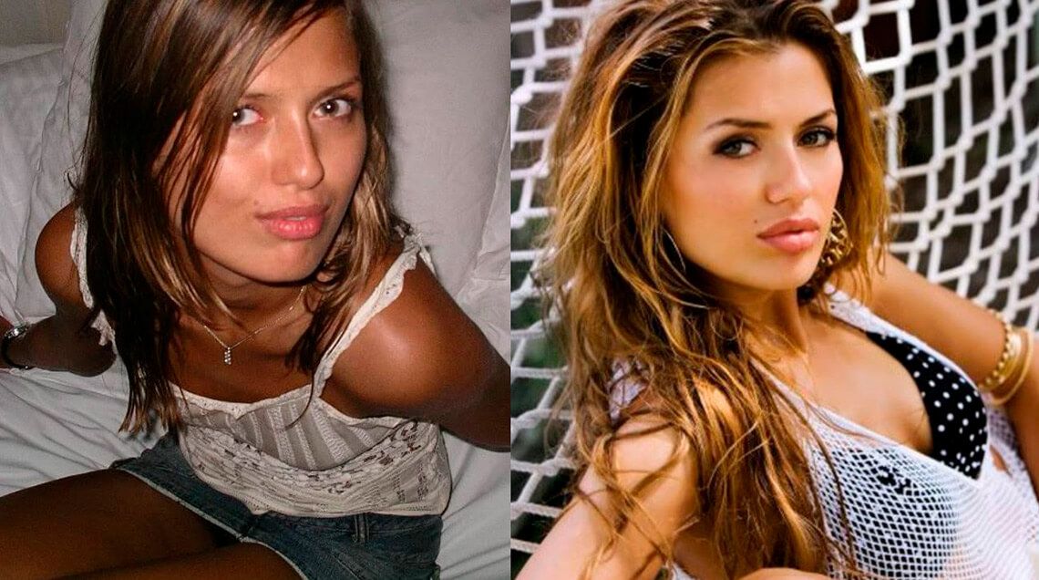 Виктория Боня до&nbsp;и&nbsp;после пластики