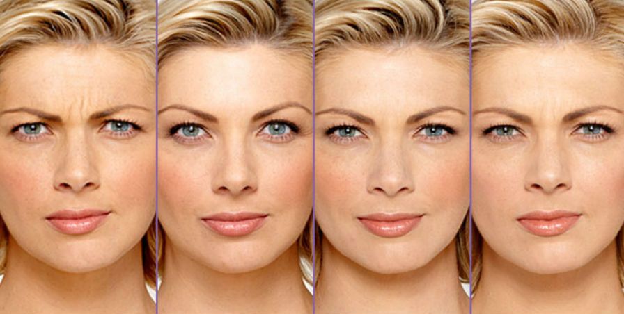 Эффект от&nbsp;инъекций ботокса