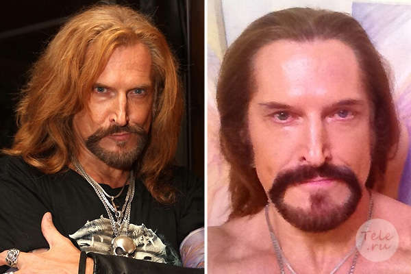 Никита Джигурда до&nbsp;и&nbsp;после пластики