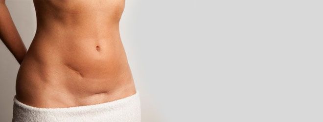 рубец на животе