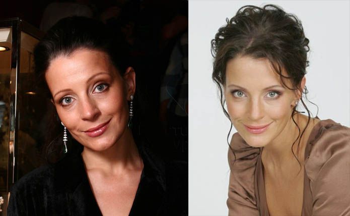 Евгения Крюкова до&nbsp;и&nbsp;после пластики