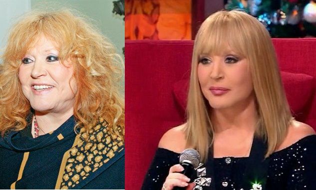 Алла Пугачева до&nbsp;и&nbsp;после пластики