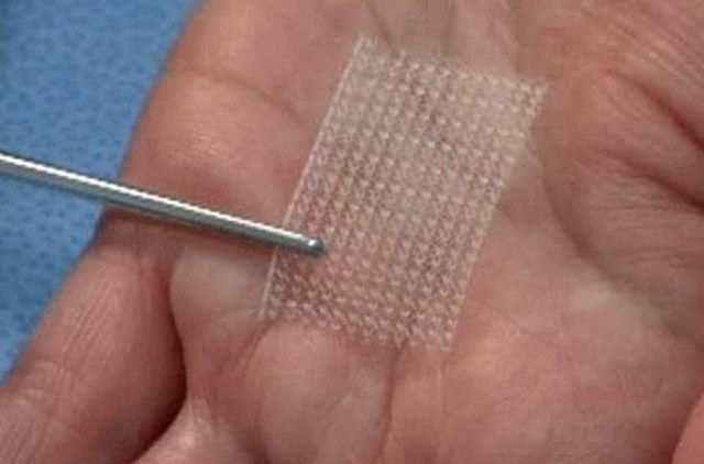 Заплатка из&nbsp;полимерного пластика