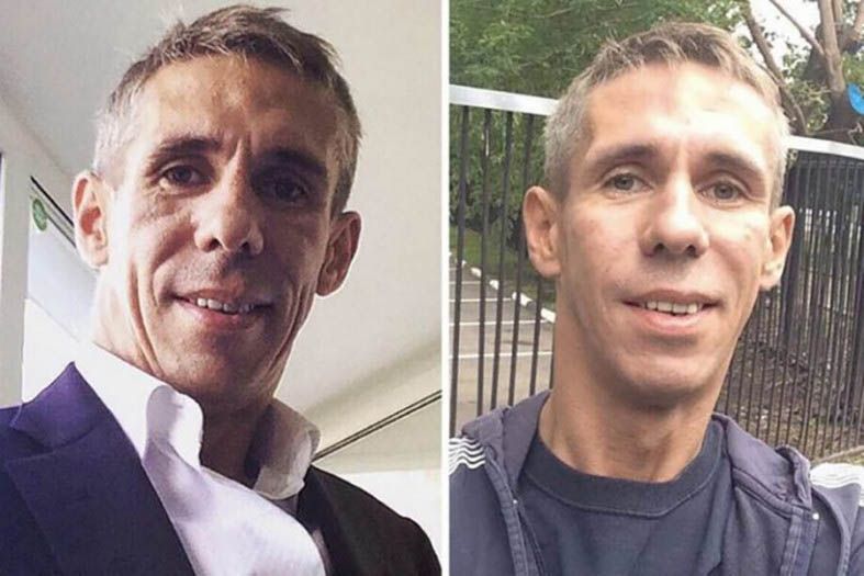 Панин пластика до&nbsp;и&nbsp;после