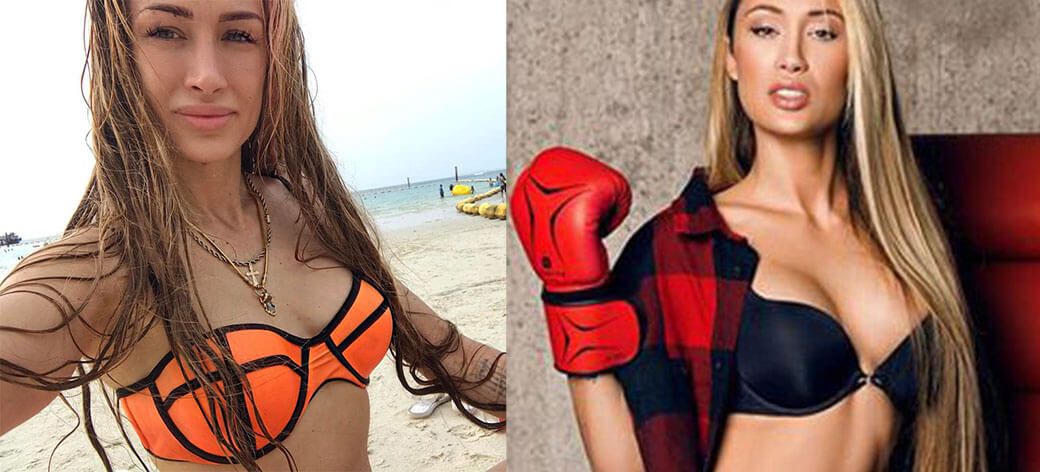 Алена Ашмарина маммопластика