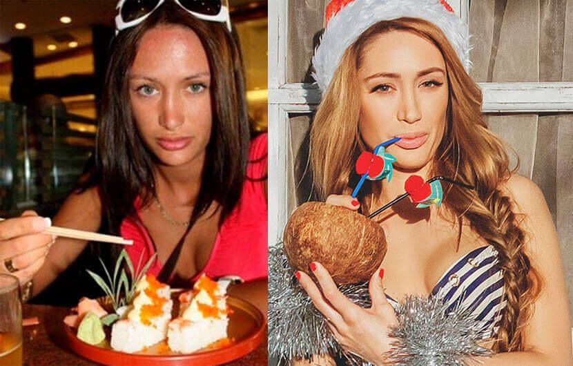 Алена Ашмарина ринопластика