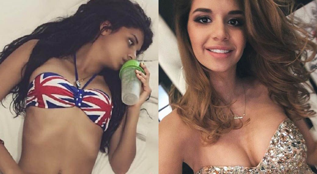 Алиана Устиненко и&nbsp;маммопластика