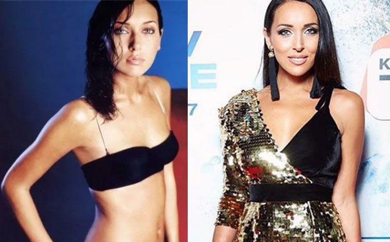 Алсу маммопластика