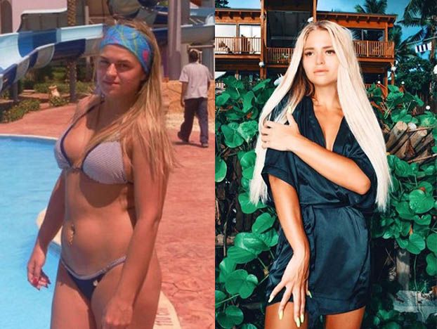 Анастасия Балинская похудение