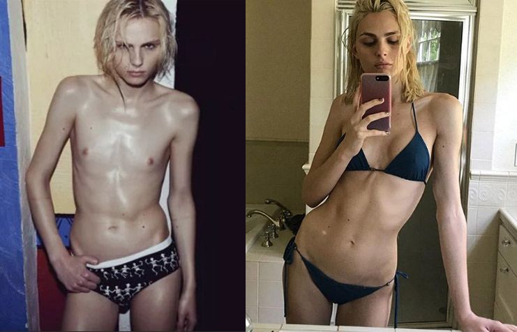 Андрей Пежич пластика по&nbsp;смене пола