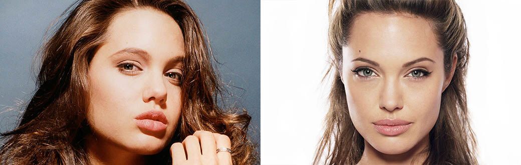 анджелина джоли до&nbsp;и&nbsp;после пластики