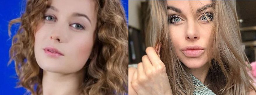 Аурика Алехина губы