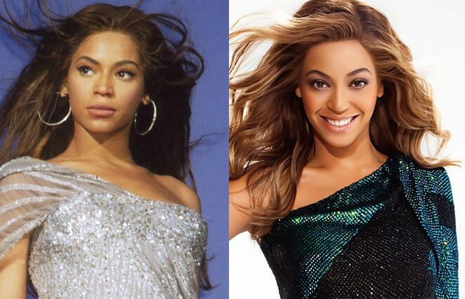 Бейонсе до&nbsp;и&nbsp;после пластики