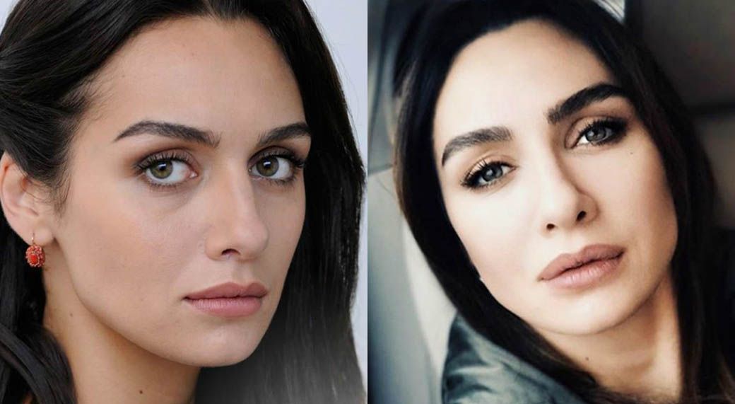 Бирдже Акалай пластика губ