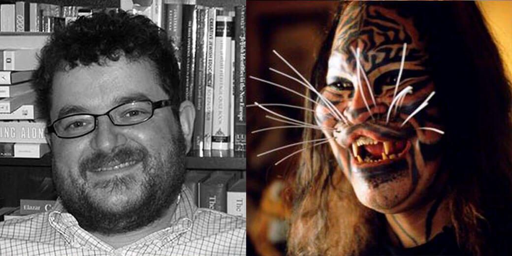 Деннис Авнер до и после пластики