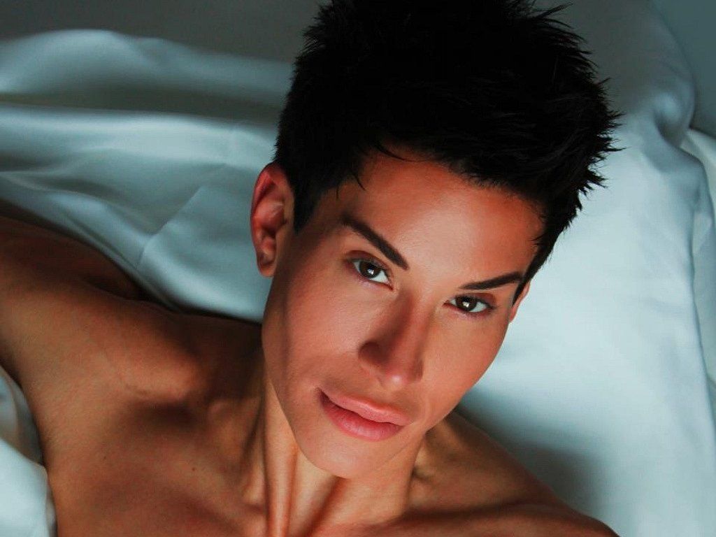 Джастин Джедлика и&nbsp;пластика лица