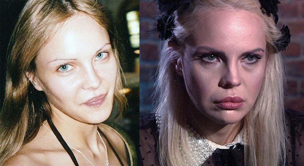 Джулия Ванг пластика губ