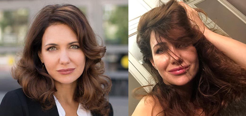 Екатерина Климова увеличение губ