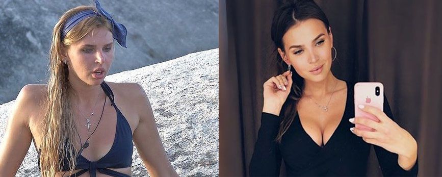 Элла Суханова маммопластика