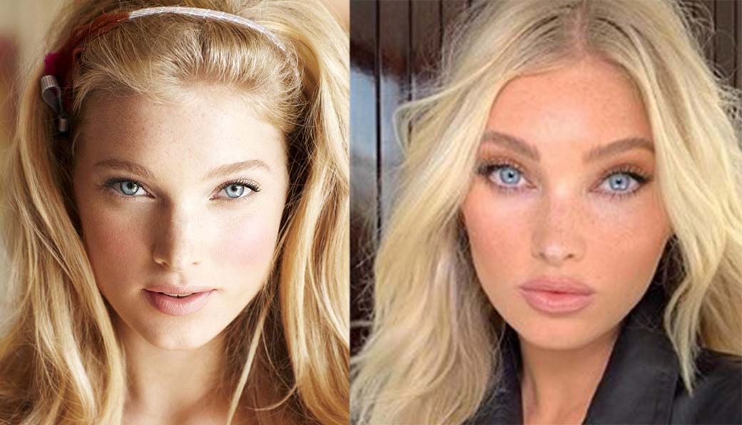 Эльза Хоск губы