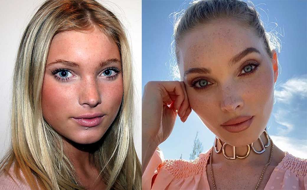 Эльза Хоск скулы