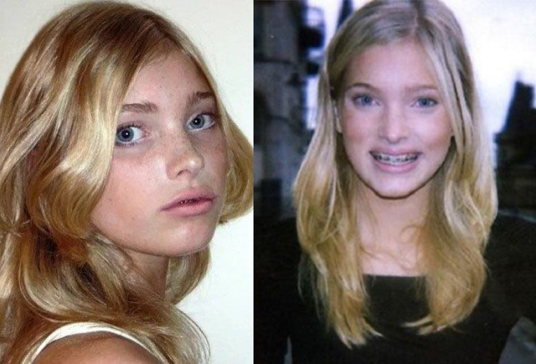 Эльза Хоск в детстве