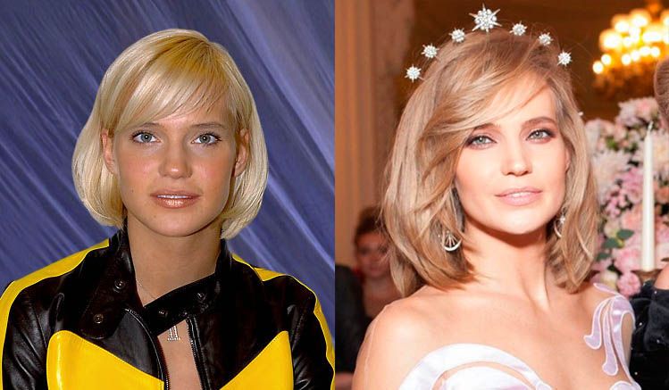 Глюкоза до и после пластики