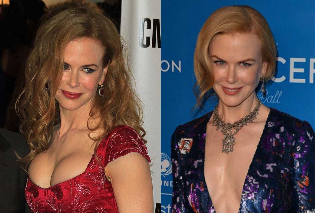 Грудь Николь Кидман