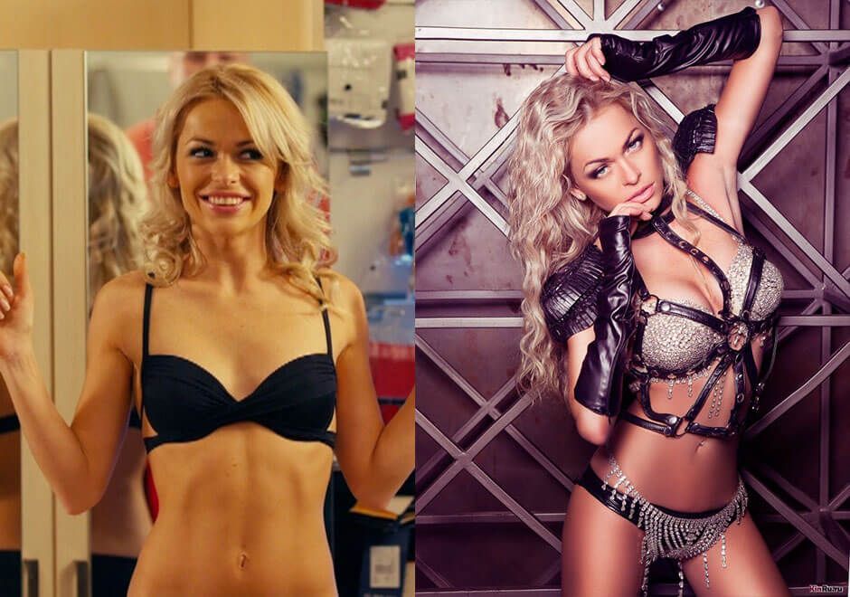 хилькевич увеличила грудь