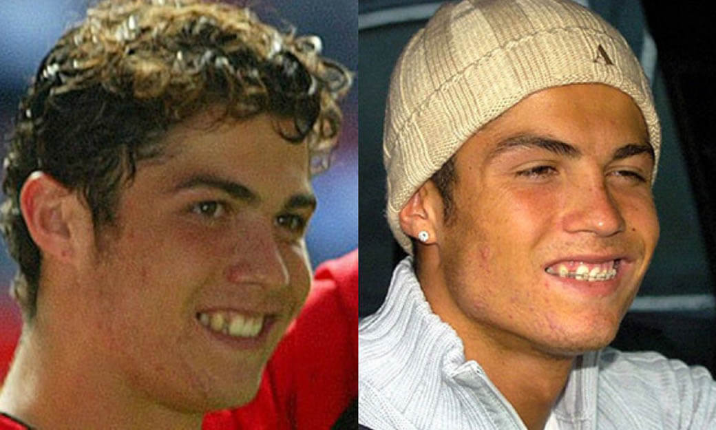 Криштиану Роналду до&nbsp;пластики