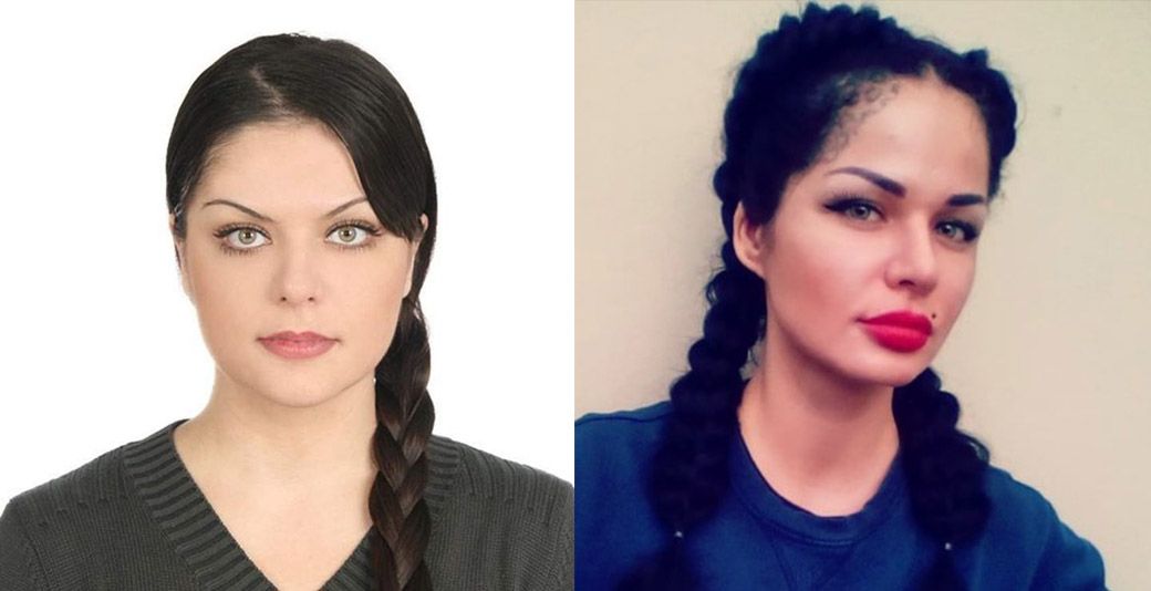 Кристина Рэй до&nbsp;пластики