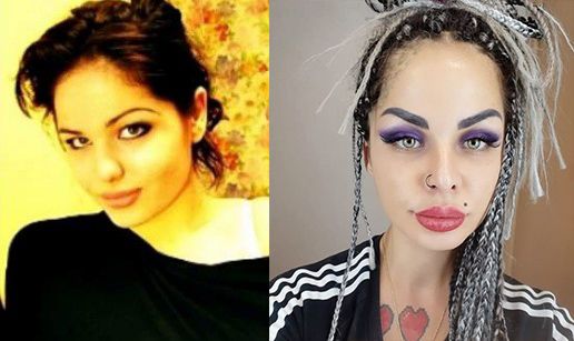 Кристина Рэй пластика