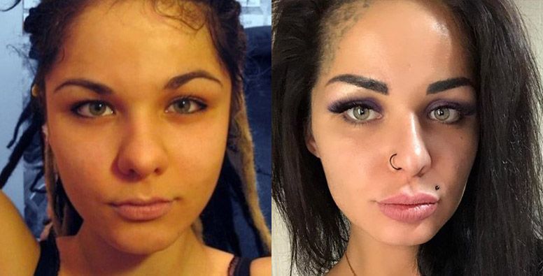 Кристина Рэй ринопластика