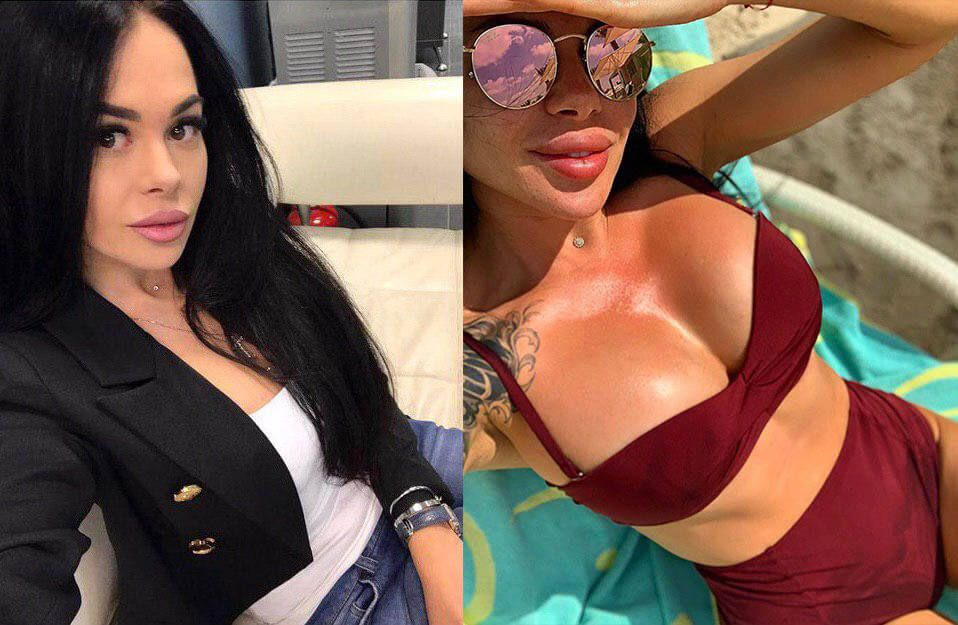 кристина сафронова до и после маммопластики