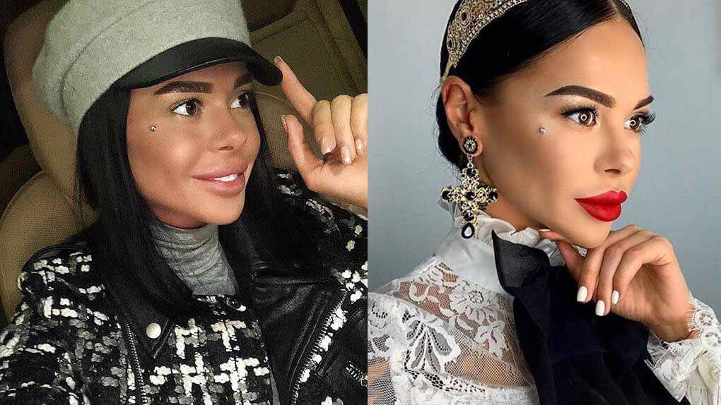 кристина сафронова ринопластика