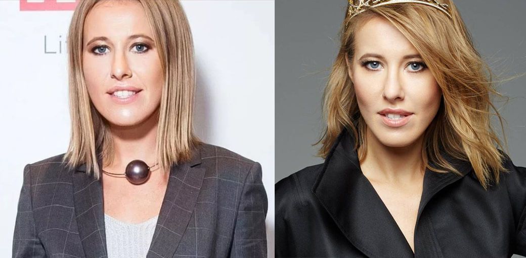 Ксения Собчак до&nbsp;и&nbsp;после пластики