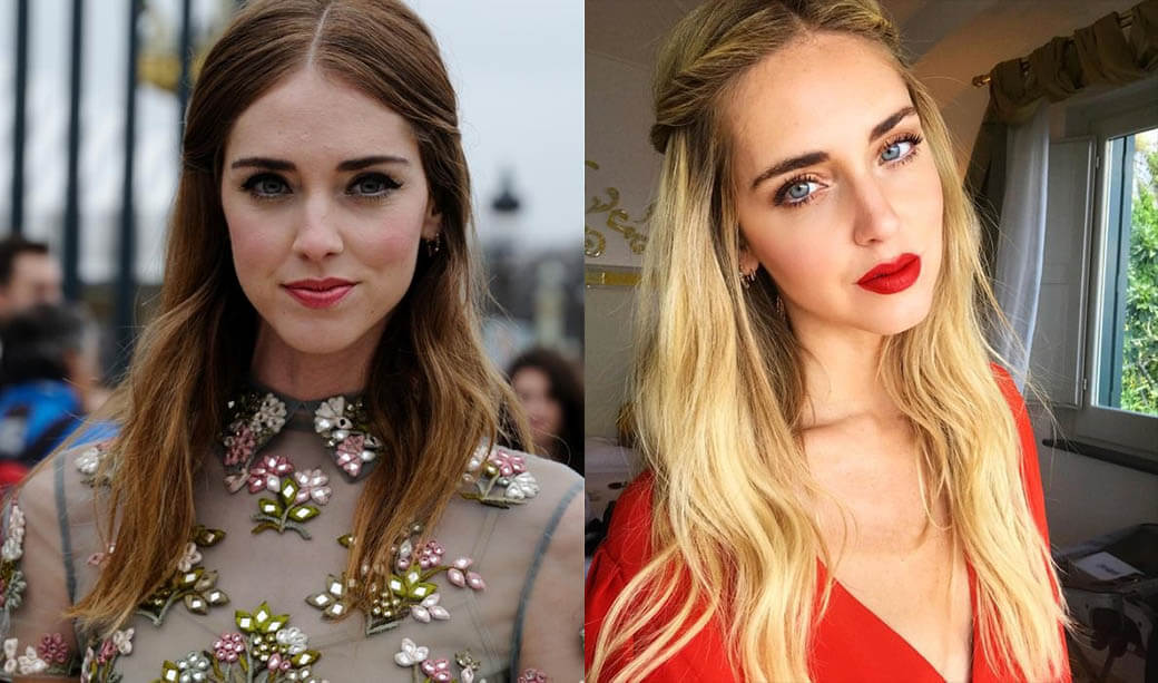 Кьяра Ферраньи и&nbsp;пластика губ