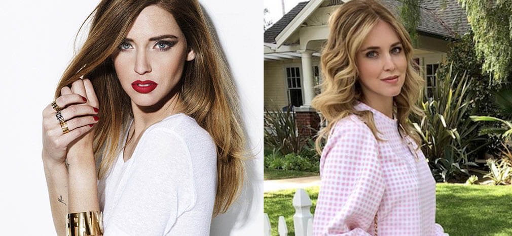 Кьяра Ферраньи и&nbsp;пластика скул