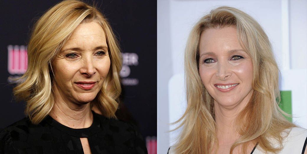 Лиза Кудроу до и после инъекций