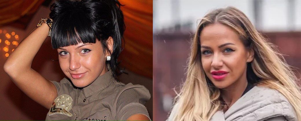 Лиза Триандафилиди до&nbsp;и&nbsp;после