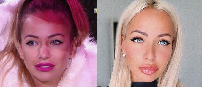 Лиза Триандафилиди губы