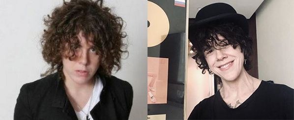 LP певица ментопластика