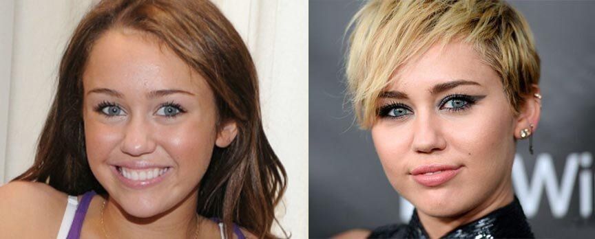 Майли Сайрус ринопластика