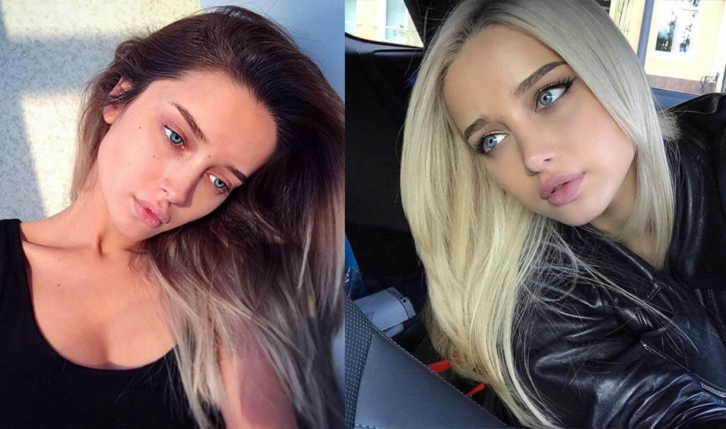 Мариам Пашаева нос